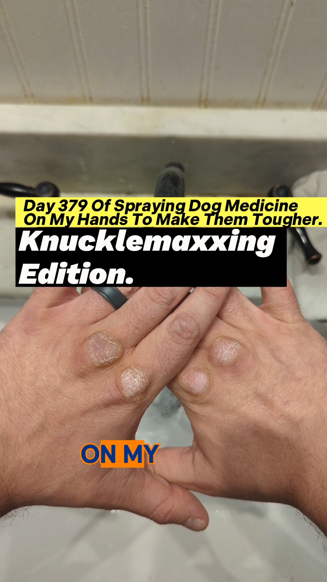 Day 379 Of Spraying Dog Medicine On My Hands To Make Them Tougher. Knucklemaxxing Edition. #roughhands #dogmedicine #ironfist #martialarts #sandpaper #boxing #badmintontraining #toughhandspray #dogspray #softhands #bluecollar #asmr #oddlysatisfying #skincareroutine #guypunchingrocks #fistofthedogmedicine #fyp 