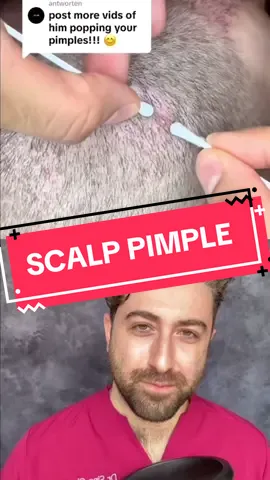 #pimplepatch #pimpleremoval #pimplepopper #pimple #acnewarrior #blackhead #cyst #acne #skincare #pimplepopping 
