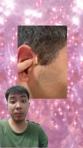 #pimple #Pimple #pimples #pimpleremover #pimplepopper2021 #pimplepopperaddict #pimplepatch #pimpleremoval #pimplepopper2022 #pimples_brufoli #satisfying #Satisfying #satisfyingvideo #satisfyingvideos #satisfyingsounds #satisfyingsound #satisfyingcleans #satisfyingasmr #satisfyingart #satisfyinglips #acne #Acne #acnetreatment #acneskin #acnefighter #acneproneskin #acnescars #acnejourney #acneskincare #acnepatch #Blackhead #blackheads #blackheadsremoval #blackheadsss #blackheadsremover #blackheadsremovalmask #blackheadsextractions #blackheadspopping #blackheadstrip #blackheadsout #blackheadsremove #foryou