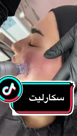 للحجز والاستفسار الرجاء التواصل على ارقام العيادة 22282999#سكارليت#فلتر#تجميل#بشرة#kuwait🇰🇼 #shapeclinic #face#face #scarlet #fpyシ #maria #اكسبلور 