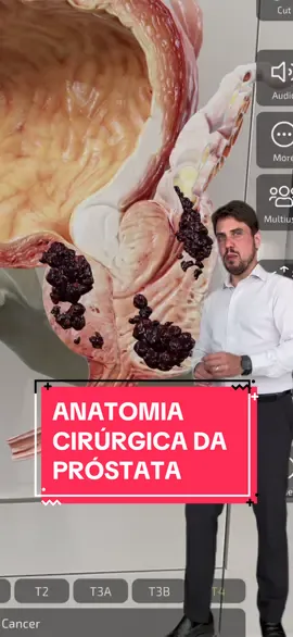 Entenda a anatomia da próstata e as estruturas importantes que estão ao seu redor #cancerdeprostata #anatomia #prostata #modelo3d 