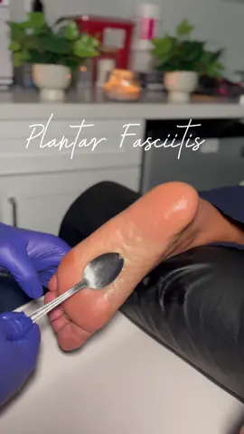 👣 Struggling with plantar fasciitis? We’ve got the solution! 🌟  Our targeted massage therapy helps get rid of plantar pain and provides lasting foot pain relief.  Don’t let foot pain hold you back—step into comfort today! 🦶💆‍♀️  #PlantarFasciitisRelief #FootPainRelief #GoodbyePlantarPain #MassageTherapy #HealthyFeet #PainFreeSteps #FootHealth #HeelPain #RelaxationMassage #WellnessJourney #footpainrelief #plantarfasciitis #painrelief 