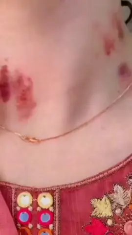 #حبيبي #اكل #ركبتي #capcut #احبكم_يا_احلى_متابعين 