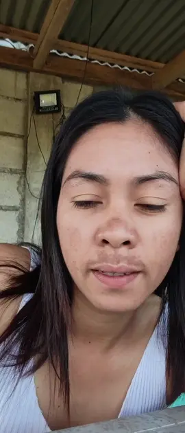 #melasmaremoval #melasmacream 