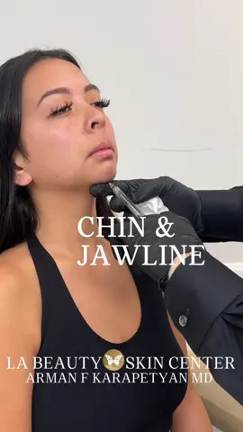 Jawline & Chin Sculpting 🤍 By @armankarapetyanmd  Call 818.888.0001 to book ✨ #jawline #chin #nonsurgical #md #medspa #drk #labeauty #fillers #iwantitigotit #viralvideo 