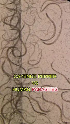 #interesting #microscope #cayennepepper #parasites #fyp #foryouu 