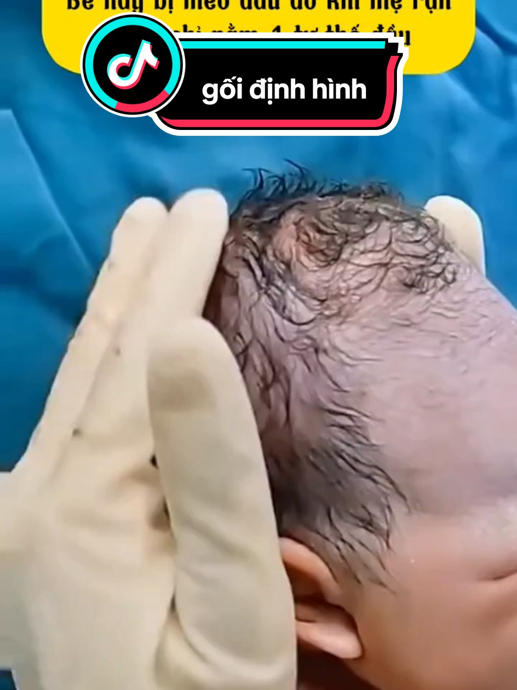 Gối định hình đầu cho bé#baby #xuhuong #mevabe #chamcon #mebimsua #yeucon #nuoicon #reviewmevabe 