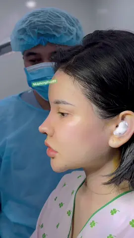 Please let me know if you like my works##goretes#nosejob#manila#philipines#hidung#thailand#indonesia#eyelidsurgery 