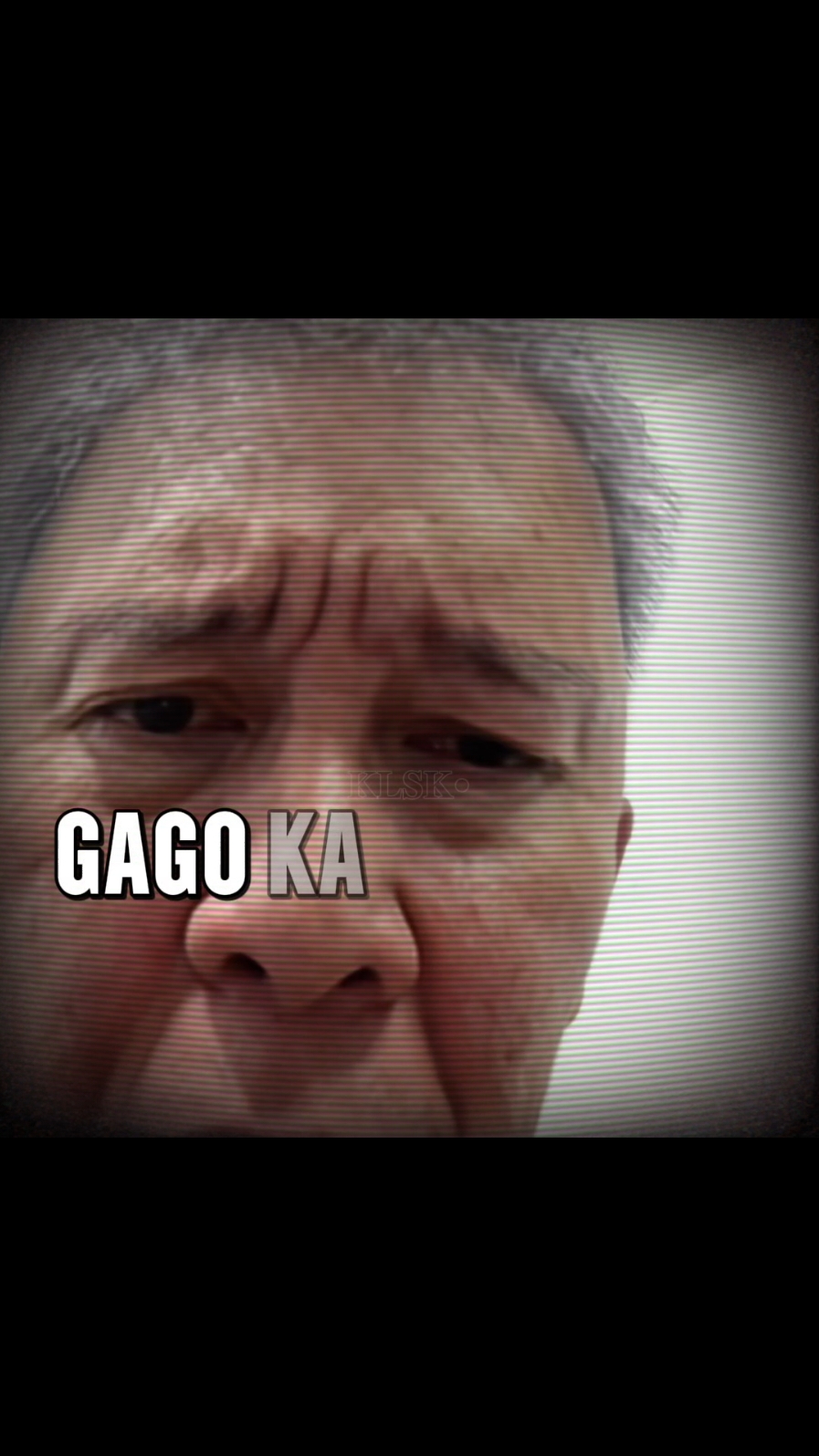 HOPE CORE LOLO KUPAL #foryou #hopecoreedit #hopecore #fyp #fyp #foryou 