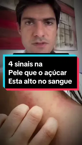 #InformaçãoDeValor #FicaADica #AprendaComigo #SaúdeNaPele #ParaVocê #Diabetes #AçúcarNoSangue #ControleGlicêmico #CuidadosComAPele #SinaisDaPele #Saúde #BemEstar #VidaSaudável #PrevençãoDeDoenças #SaúdeÉPrioridade