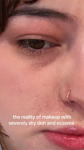 someone pls help me fix this ive tried every moisturizer and my skin still flakes 😭 #fyp #foryou #makeup #foryoupage #eczema #fyppp #fyppppppppppppppppppppppp 