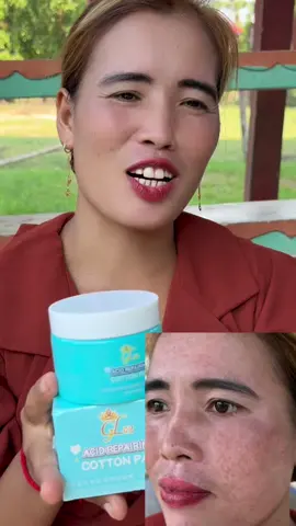 ជូតដោយគ្រាប់មុនតាំងពី3ថ្ងៃដំបូង❤️️​  #សំឡីជូតមុខgl72collagen  #fyp  #foryou  #for  #tiktok 