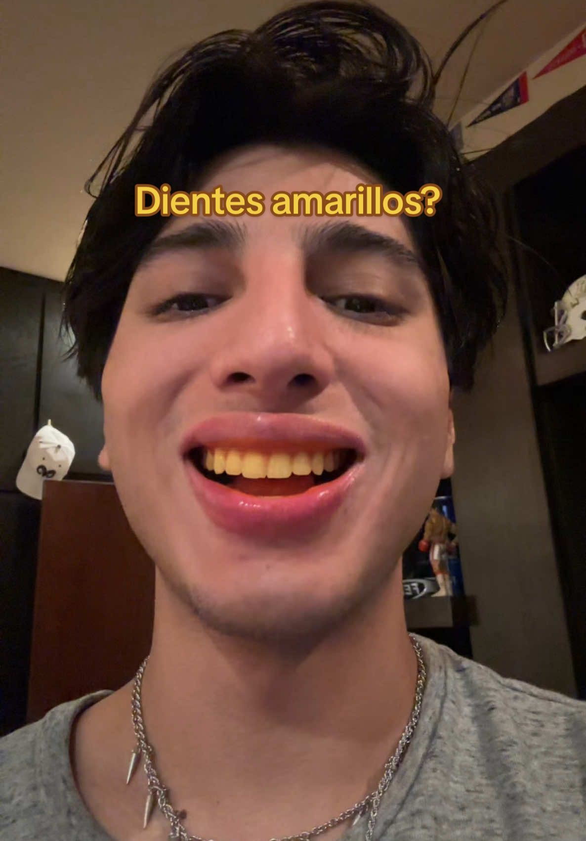Dientes amarillos? #dientes #dentista #mty #higiene #paratiiiiiiiiiiiiiiiiiiiiiiiiiiiiiii #fyp #skincaretips 