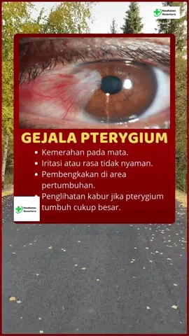 Mata terasa seperti ada yang mengganjal? Bisa jadi itu gejala pterygium! Tonton video ini untuk tahu lebih lanjut tentang tanda-tanda dan penyebabnya. Jangan sampai terlambat, segera periksakan mata Anda! 👁️✨ #pterygium  #gejalamata  #kesehatanmata  #matasehat  #tipskesehatan  #cegahpterygium  #mataganjal  #PterygiumAwarenes  #MataSehatSetiapHari #fypシ゚ #fypp #fyppppppppppppppppppppppp #fypage #foryou #fyp 