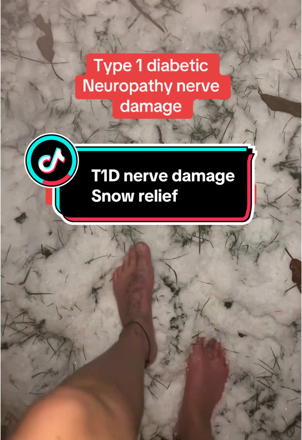 The relief it gives 🥰😍  #diabetic #diabetes #nervedamage #neuropathy #typeonediabetes #t1d #diabeticcomplications #health #awareness #diabetesawareness #EduTok #fyp 