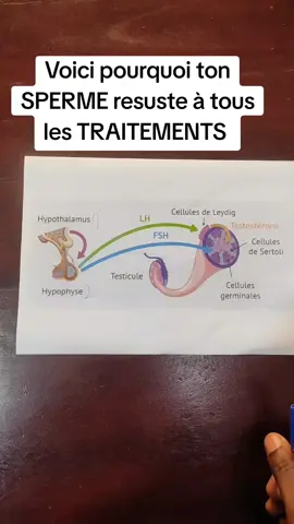 Voici pourquoi ton sperme résiste à tous les traitements  #fertilitytreatment #fertilidade #varicocele #varicosetreatment #aphrodisiquenaturel #varicocèle #nopalpharma #nopal_pharma #astucesanté #santénaturelle #fertility #fertilityjourney #fertilité #menfertility #menfertilitybooster #abidjan_tiktok #libreville_gabon🇬🇦 #lometiktok🇹🇬🇹🇬 #brazzavilletiktok🇨🇬 #dakarbuzz 