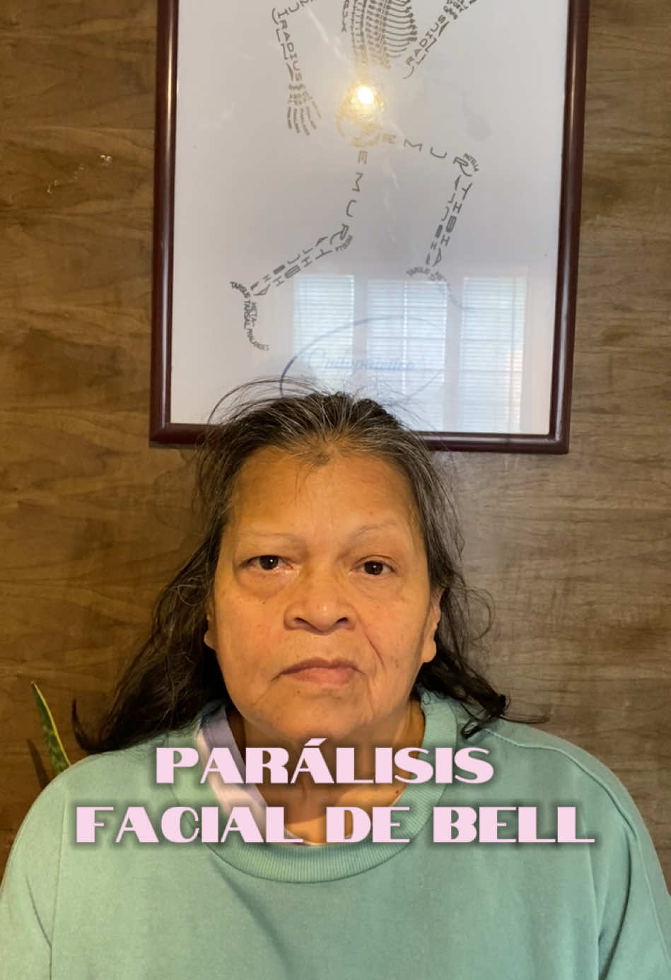 Parálisis facial #rehabilitacion #rehabilitation #vertebral #paralisisfacial #paralisisfacialdebell 