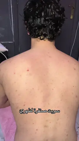 صنفرة الجسم 🧴 والله ياهي قوية وخلال استخدام اسبوع تحصل ظهرك يصفى تلقائياً من الحبوب والاثآر والبكتيريا🦠🤝🏻  رابط المتجر للطلب بالبايو وحساب المتجر هنا @Amal.organic🧴✨  #skincare #bodycare #backcare #amal_organic 