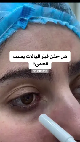 #ظافر_ال_حافظ #ظافر_الحافظ #الفيلر#فيلر_الهالات#الفيلر_يسبب_عمى#العمى#عمى#مضاعفات_الفيلر