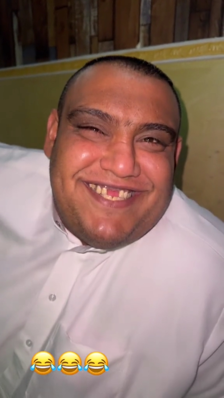 #komedi #funnyvideos #funny  #tiktoktürkiye #tiktok #hahaha #tiktokvideoları #funnyvideo #enkomikvideolar #komikvidyolar #Love #funnymoments #trending #foryou #capcut  #humor 