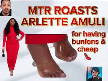 Thats 🥶 #fyp #arletteamuli #mediocretutorialandreviews #feet #pedicure #bunion #heels 