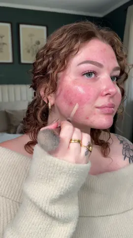 2 great products in general but especially great for those with sensitive skin !!! This is the @IT Cosmetics Bye Bye Redness Serum & CC Cream 🤌 10/10 ✨ Their Black Friday sale is also happening from November 25th until Dec 2nd 👀 #itcosmeticsparter 🤍 #itcosmetics #sensitiveskin #redness #rosacea #cccream #fullcoverage #dryskin #texturedskin #foundation #review #byebyeredness #skincare 