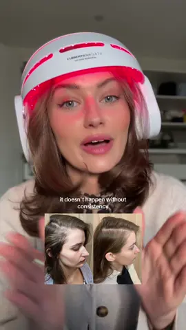 not sponsored but I do have a code (SARAHPALMYRA) for 20% off the @currentbody LED hair growth helmet which has been the most effective thing I’ve tried so far for hair growth. #ledhairgrowth #hairlossjourney #hairgrowth #ledhelmet #currentbody #redlightmask 