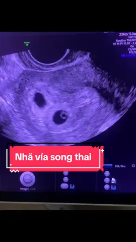 Ba tặng mẹ cặp nhẫn hột xoàn quá đỉnh 😍- Song thai tự nhiên khác trứng 6w3d- hai nhau hai ối tim thai rộn ràng #huynhbaotran84 #sieuamthai3thangdau #nhạcthaigiao #thaikhoemanh #timthaironrang #thaigiaoconyeu #songthaikhactrung