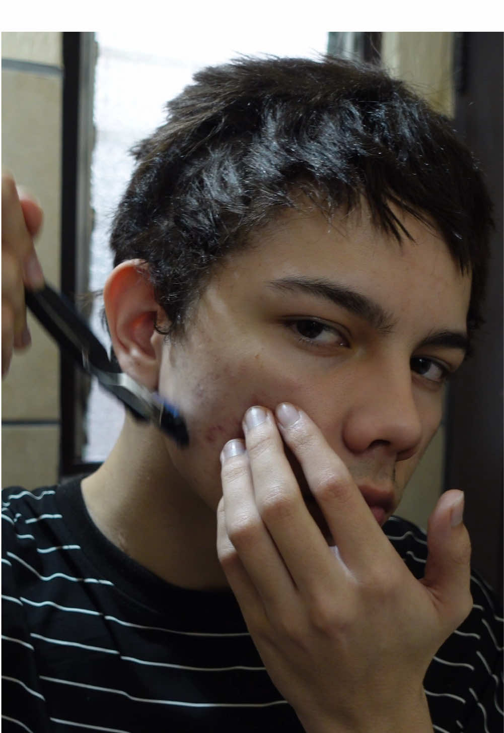 #skincare #acne #skincareroutine #fypシ 