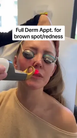 Full video on YT 🫶🏻 @DrClaireWolinsky  . #sebaceoushyperplasia #brownspots #redness #rosacea #rosaceatreatment #dermatology #skincare #fypシ 
