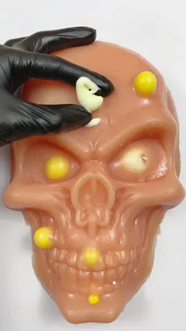 Clear pimples on face skull💀! Satisfying? #acnetreatment #howtomakepimples #satisfying #asmrsounds #asmr #us #fypシ #skincare #pimplepopping #viralvideo #relax #asmrtingles #mouthsounds #pimple_popper_asmr #tingles #fypviral #foryour #visualasmr #mochipimplepopping #bonniepimplepopperasmr #skull 