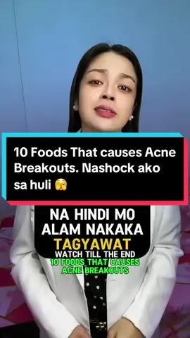 10 Foods That causes Acne Breakouts. Nashock ako sa huli 🫣 #health #healthy #healthyliving 