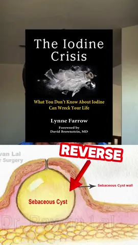 Why iodine is beneficial to your wellbeing. #holistichealth #holistichealing #holisticwellness #holistichealthcoach #holisticmedicine #holisticnutrition #healthy #health #healthyrecipes #healthyliving #healthtips #tips #tipsandtricks #hacks #hacksandtips #fyp #fypシ #fypシ゚viral #viralvideo #viral_video #viralvideos #trending #trends #trendingsound #blowthisuptiktok 
