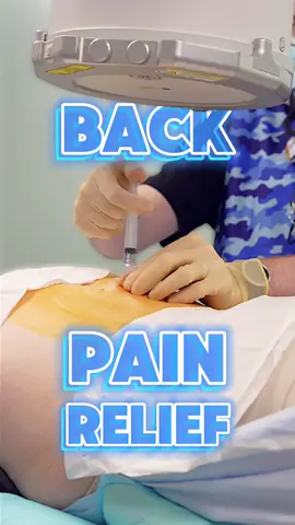 An epidural steroid injection is like giving your spine a little extra help to fight pain. By injecting a powerful steroid into the space around your spinal cord, it reduces inflammation and eases discomfort, letting you move and feel better again. It’s a targeted way to tackle pain from things like herniated discs or spinal stenosis without major surgery! #backpain #painrelief 