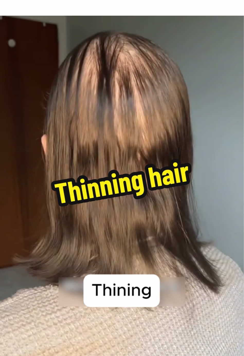The secret of hair growth 🪄✨🤩#fyp #trending #hairloss #hairregrowth #hairgrowth #hairtok #shinyhair #hairlong #hairstyle #haircare #biotin #hairskinnails #thinninghair 