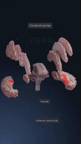 3D brain anatomy - explore neuroanatomy with VOKA 3D Anatomy & Pathology   Discover key regions such as the cerebrum, responsible for higher cognitive functions like decision-making and memory; the cerebellum, essential for coordination and balance; the brainstem, which controls vital autonomic processes like breathing and heart rate; and the limbic system, the hub of emotions and behavioral responses.    Whether you're exploring brain disorders or deepening your understanding of its intricate functions, this 3D model will revolutionize your learning experience!   #brainanatomy #neuroscience #neuroanatomy #cerebrum #3danatomy #humanbody #medstudent #medicaltsudent #3danimation 