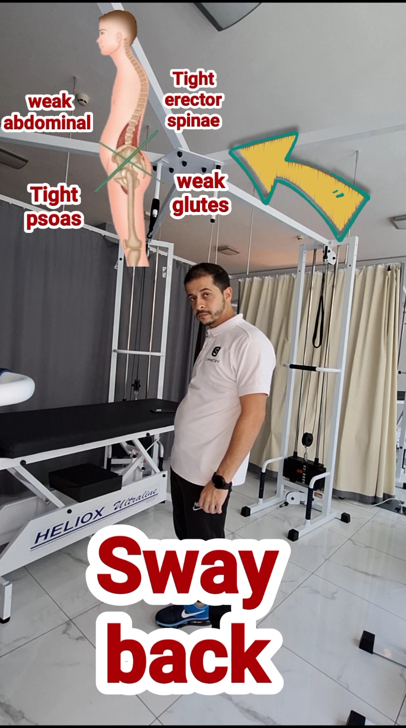 fix your sway back with this exercise ☝️ #ti̇ktok #reels #Home #physiotherapy #advice #dubai #uae 