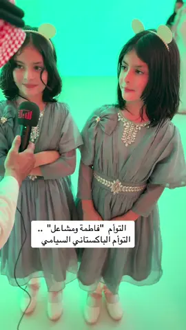 #المؤتمر_الدولي_للتوائم_الملتصقة 