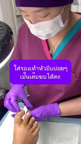 ใส่รองเท้าหัวบีบเป็นประจะทำให้เป็นเล็บขบได้ง่ายคะ#ingrowntoenail #wefootตัดเล็บขบรักษาเล็บเชื้อรา #เล็บขบหนักมาก #เล็บขบอักเสบ #ตัดเล็บขบมียาชา #ตัดเล็บขบ #เล็บขบ 