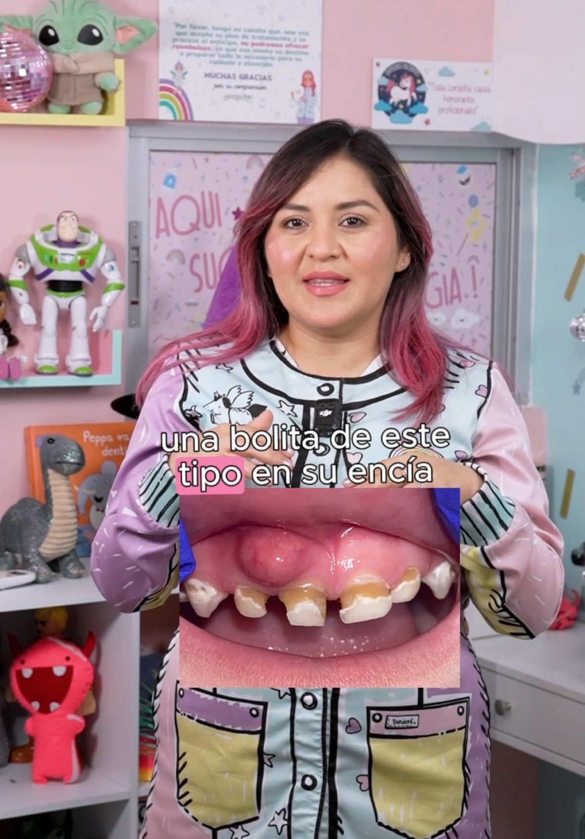 Cuidado con las bolitas de pus en la encía! Las infecciones dentales pueden aparecer por traumatismos o por caries no tratadas a tiempo. Aunque a veces no generan dolor, esto no significa que debamos ignorarlas. Si no se atienden, estas infecciones pueden avanzar y afectar otras estructuras cercanas, poniendo en riesgo tu salud bucal y en general. No esperes a que el problema crezca. Agenda tu cita hoy mismo y permite que cuidemos de tu sonrisa. En Dentalitos🌈, somos especialistas en odontopediatría, ortopedia y ortodoncia. Nos dedicamos a cuidar las sonrisas de chicos y grandes en un ambiente cómodo y acogedor, con el mejor equipo y materiales de alta calidad. ¡No esperes más para darle a tu sonrisa la atención que merece! 📅Agenda tu cita hoy. Nos ubicamos en La ciudadela  Citas : 999 907 4598 #dentista #dentistamerida #kiddentist #tipsdentalitos  #ortodoncia#dentalitos #sonrisa #smile #odontologo #teeth #brackets #smile #dentistas #denticioninfantil #ortodonciainterceptiva #odontopediatra #kids #ortopediamaxilar #ratoncitodelosdientes