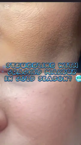 Winter is here, and let me tell you—my skin felt it! 🥶 Dry patches, flaky makeup, and cracked foundation were my reality... until I found the perfect duo: the Dive-In Serum and Balanceful Cica Cream from @𝗧𝗼𝗿𝗿𝗶𝗱𝗲𝗻 토리든 @TORRIDEN US  . ✨ Why I love it: The Dive-In Serum is a game-changer! Its lightweight, watery texture absorbs in seconds, leaving my skin plump and hydrated. It’s now my go-to prep for makeup because it keeps everything smooth and crack-free. The Balanceful Cica Cream is my savior for locking in moisture while calming my sensitive skin. No more dry, tight feeling after stepping out in the cold—it’s like a cozy blanket for my skin! 💧 Pro Tip: Start with the serum to boost hydration, then follow up with the cream to seal everything in. Your foundation will thank you! And the best part? These are 45% OFF on amazon right now during Black Friday and Christmas! 🎁 Don’t sleep on this deal. Have you tried these yet? Let me know your go-to winter skincare saviors! 💙 Kindly #giftedby #torriden #winterskincare #hydration #skincarereview #blackfridaydeals #christmas #koreanskincare #makeupprep #skincaretips #skincare #grwm #kbeauty #skincareroutine #acneproneskin #cicacream #calmingskincareroutine #calmingskin #coldweather #skincare #bf #blackfriday #christmas 