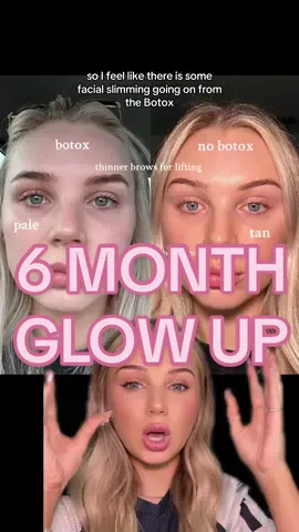 everything i did to glow up in 6 months ✨🫶🏼 #GlowUp #glowuptips #looksmaxing 