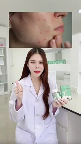 ร่างกายขาดซิงค์ อาจทำให้เกิดสิว #ซิงค์ #zinc #zincwinkwhite #วิตามิน #วิงค์ไวท์ #winkwhite #รีวิววิตามิน #รีวิวบิวตี้ #รีวิวของดีบอกต่อ #รีวิวซิงค์ #รีวิววิงค์ไวท์ 