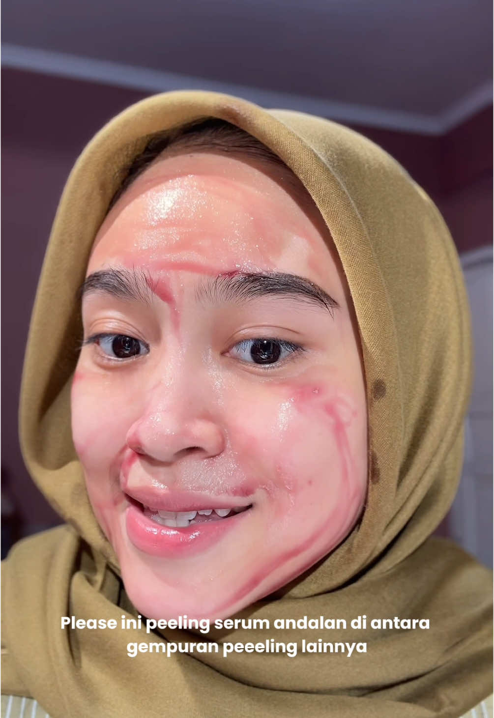 Cekat cekit yg nagih si kalo ini #elformula #peelingserum 