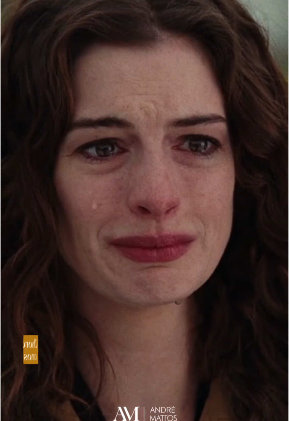 Envelhecer com naturalidade e confiança é o segredo! No vídeo, Anne Hathaway aos 41 anos, mais elegante e com a expressão relaxada, mostra como pequenos cuidados fazem toda a diferença. Quer experimentar esse toque de elegância para você também? O Botox Day está chegando, em 05/12! Últimos horários disponíveis para agendamento. Não deixe para depois, garanta seu cuidado personalizado, clique no link da bio e fale conosco! 👨‍⚕️D️r André Mattos – Médico Cirurgião Plástico   CRM 52487865/ RQE 5779 👨‍⚕️Niterói e Leblon – RJ #botox #botoxfacial #harmonizaçãafacial #fullbotox #anne #linhasdeexpressao #annehathaway 