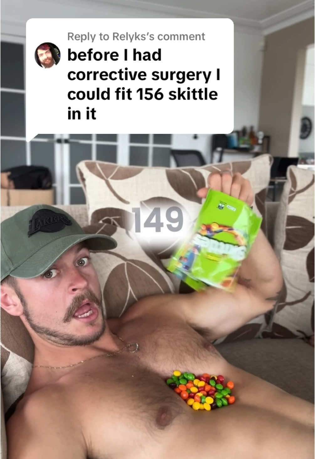 Replying to @Relyks we ran out! 🥲 #pectus #pectusexcavatum? #pectusgang #skittles 