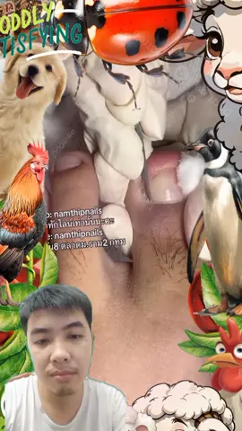 ingrown toenail pedicure #toenail #toenails #nail #nails #pedicure #ingrowntoenail #satisfyingvideo 