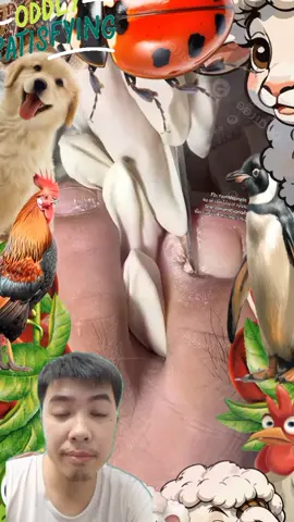 ingrown toenail pedicure #toenail #toenails #nail #nails #pedicure #ingrowntoenail #satisfyingvideo