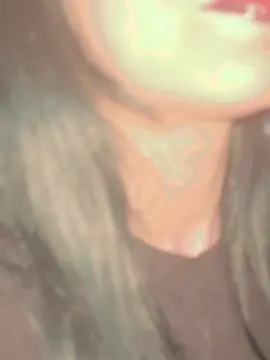 #vaiprofycaramba #vitiligogirl 