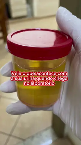 Curiosidade da semana. Vejam como acontecem as análise de rotina… #pourtoi #jungkook #greenscreen #video #neiperte #keşfet #capcut #xh #anime #quran #explore #relatable #dúo #fyp #xzyabc #tutorial 